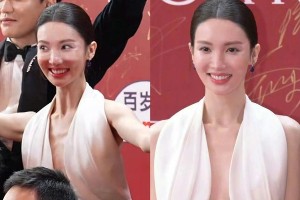 金晨整容后遗症明显：面部僵硬、鼻子变形引热议